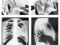 Positioning in Radiography